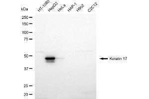 Western blotting analysis using keratin 17 antibody (ABIN7799171).