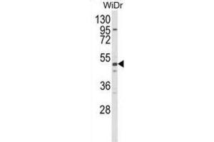 Western Blotting (WB) image for anti-Aldehyde Dehydrogenase 5 Family, Member A1 (ALDH5A1) antibody (ABIN2998190) (ALDH5A1 Antikörper)