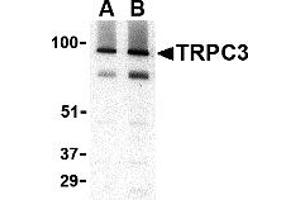 Western Blotting (WB) image for anti-Transient Receptor Potential Cation Channel, Subfamily C, Member 3 (TRPC3) (C-Term) antibody (ABIN1030778) (TRPC3 Antikörper  (C-Term))