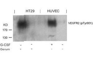 Image no. 2 for anti-VEGF Receptor 2 (VEGFR2) (pTyr951) antibody (ABIN196770) (VEGFR2/CD309 Antikörper  (pTyr951))