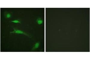 Immunofluorescence analysis of HeLa cells, using p53 (Ab-20) Antibody. (p53 Antikörper  (AA 10-59))