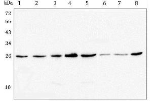 Western blot analysis of GSTM1 using anti-GSTM1 antibody (ABIN5693233).