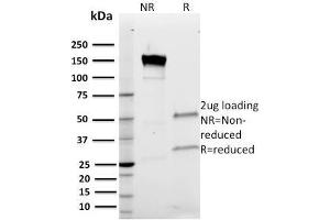 SDS-PAGE Analysis Purified Band III Mouse Monoclonal Antibody (Q1/156). (Band 3/AE1 Antikörper)