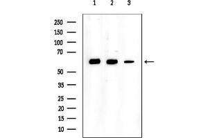 Western blot analysis of lysates from various samples, using PKM2 Mouse Monoclonal Antibody at 1/1000 dilution.
