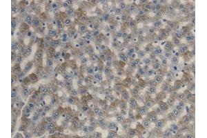 Detection of FADS1 in Rat Liver Tissue using Polyclonal Antibody to Fatty Acid Desaturase 1 (FADS1) (FADS1 Antikörper)