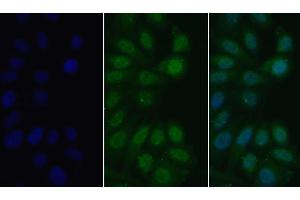 Detection of MyD88 in Human HepG2 cell using Polyclonal Antibody to Myeloid Differentiation Factor 88 (MyD88) (MYD88 Antikörper  (AA 32-265))