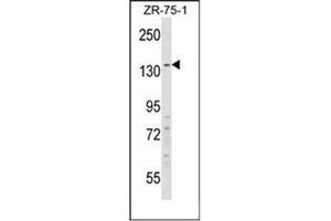 Western blot analysis of RFX1 Antibody (C-term) in ZR-75-1 cell line lysates (35ug/lane).