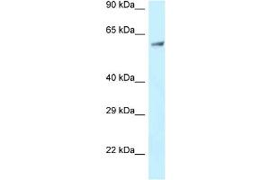 WB Suggested Anti-CLINT1 Antibody Titration: 1.