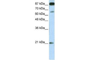 WB Suggested Anti-NFATC4 Antibody Titration:  1. (NFATC4 Antikörper  (Middle Region))