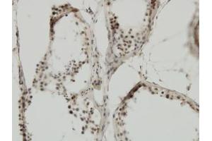 Image no. 5 for anti-Tripartite Motif Containing 24 (TRIM24) (AA 432-569) antibody (ABIN599067) (TRIM24 Antikörper  (AA 432-569))