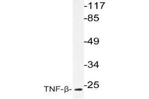 Western blot (WB) analysis of TNF-beta antibody in extracts from COS-7cells. (LTA Antikörper)