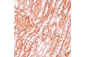 Immunohistochemistry of paraffin-embedded mouse kidney using Caspase-9 antibody (ABIN3016349, ABIN3016350, ABIN3016351 and ABIN6219728) at dilution of 1:100 (40x lens).