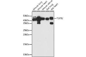 Western blot analysis of extracts of various cell lines, using TGFB2 antibody (ABIN1683015, ABIN3017925, ABIN3017926 and ABIN6220307) at 1:1000 dilution. (TGFB2 Antikörper  (AA 20-160))
