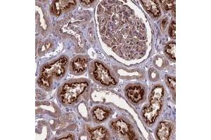Immunohistochemical staining of human kidney with MFSD8 polyclonal antibody  shows distinct cytoplasmic and membranous positivity in cells in tubules at 1:50-1:200 dilution. (MFSD8 Antikörper)