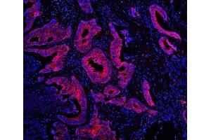 anti-Tudor Domain Containing 3 (TDRD3) antibody