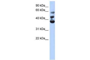 NSUN3 antibody used at 1 ug/ml to detect target protein.