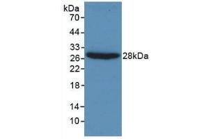 Detection of Recombinant Gelsolin, Human using Monoclonal Antibody to Gelsolin (GSN) (Gelsolin Antikörper  (AA 432-553))