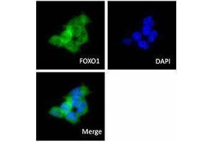 Immunofluorescence (IF) image for anti-Forkhead Box O1 (FOXO1) antibody (ABIN2664978) (FOXO1 Antikörper)