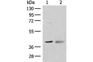 Western blot analysis of Mouse kidney tissue and Human fetal brain tissue lysates using ADH5 Polyclonal Antibody at dilution of 1:500 (ADH5 Antikörper)