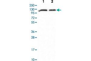 Western blot analysis of Lane 1: Human cell line RT-4 Lane 2: Human cell line U-251MG with ADAR polyclonal antibody  at 1:500-1:1000 dilution. (ADAR Antikörper)