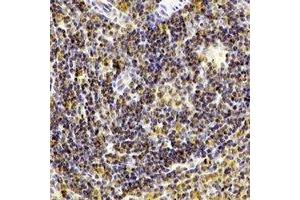 Immunohistochemical analysis of CD238 staining in human spleen formalin fixed paraffin embedded tissue section. (KEL Antikörper)