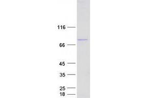 DDX3X Protein (Myc-DYKDDDDK Tag)