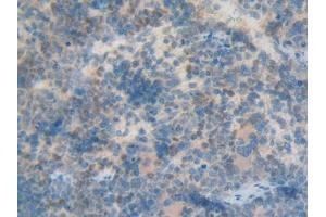 Used in DAB staining on fromalin fixed paraffin- embedded kidney tissue (KRT12 Antikörper  (AA 398-456))