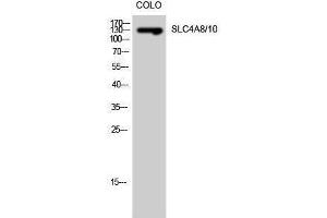 Western Blotting (WB) image for anti-Solute Carrier Family 4, Member 8/10 (SLC4A8/10) (Internal Region) antibody (ABIN3186974) (SLC4A8/10 Antikörper  (Internal Region))