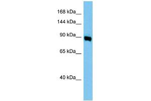 WB Suggested Anti-Ap1g1 Antibody Titration: 1. (gamma 1 Adaptin Antikörper  (Middle Region))