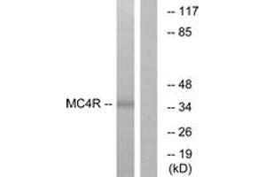 Western Blotting (WB) image for anti-Melanocortin 4 Receptor (MC4R) (AA 281-330) antibody (ABIN2890891) (MC4R Antikörper  (AA 281-330))