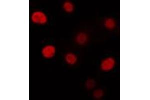 ABIN6274332 staining Hela cells by IF/ICC. (CHAF1B Antikörper  (N-Term))