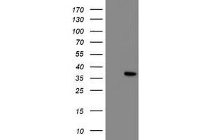 HEK293T cells were transfected with the pCMV6-ENTRY control (Left lane) or pCMV6-ENTRY NRIP3 (Right lane) cDNA for 48 hrs and lysed. (NRIP3 Antikörper)