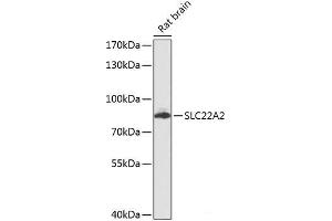 Western blot analysis of extracts of Rat brain using SLC22A2 Polyclonal Antibody at dilution of 1:1000. (SLC22A2 Antikörper)