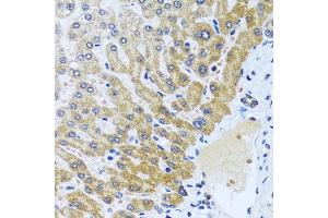 Immunohistochemistry of paraffin-embedded human liver using CP antibody (ABIN6129673, ABIN6138930, ABIN6138932 and ABIN6217722) at dilution of 1:100 (40x lens). (CPA6 Antikörper  (AA 130-437))