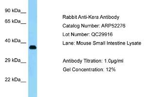Western Blotting (WB) image for anti-Keratocan (KERA) (C-Term) antibody (ABIN2784856) (KERA Antikörper  (C-Term))