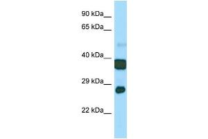 Host:  Rabbit  Target Name:  Atp5c1  Sample Type:  Mouse Stomach lysates  Antibody Dilution:  1. (ATP5C1 Antikörper  (N-Term))