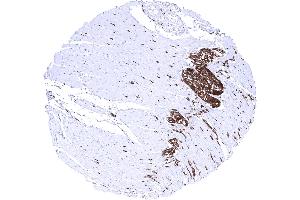 Colon descendes muscular wall Strong PGP9.