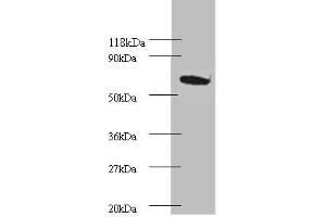 Western blot All lanes: Proteasome subunit beta type-4 Antibody at 2 μg/mL + EC109 whole cell lysate Secondary Goat polyclonal to rabbit IgG at 1/15000 dilution Predicted band size: 30 kDa Observed band size: 75 kDa (PSMB4 Antikörper  (AA 46-264))