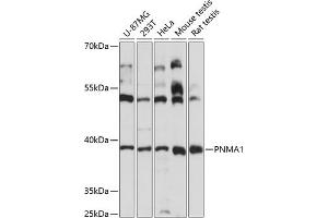 Western blot analysis of extracts of various cell lines, using PNM antibody (4558) at 1:3000 dilution. (PNMA1 Antikörper  (AA 1-353))