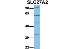 WB Suggested Anti-SLC27A2 Antibody Titration:  1 ug/ml  Positive Control:  Jurkat lysate (SLC27A2 Antikörper  (N-Term))