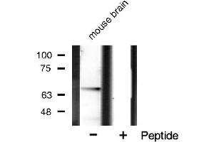 Western blot analysis of PAK1 phosphorylation expression in mouse brain tissue lysates,The lane on the right is treated with the antigen-specific peptide.