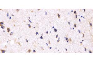 Immunohistochemistry of paraffin-embedded Rat brain using PPP2R4 Polyclonal Antibody at dilution of 1:200 (40x lens). (PPP2R4 Antikörper)
