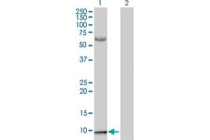 Western Blotting (WB) image for S100A2 293T Cell Transient Overexpression Lysate(Denatured) (ABIN1333375)