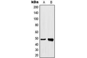 Western blot analysis of hnRNP H expression in A549 (A), HeLa (B) whole cell lysates. (HNRNPH1 Antikörper  (Center))