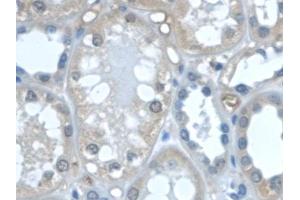 Immunohistochemistry (IHC) image for anti-Transforming Growth Factor, alpha (TGFA) (AA 24-98) antibody (ABIN7425710)