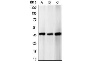 Western blot analysis of p39 expression in SHSY5Y (A), HeLa (B), U87MG (C) whole cell lysates. (p39 (Center) Antikörper)
