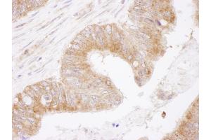 Immunohistochemistry (IHC) image for anti-B-Cell CLL/lymphoma 2 (BCL2) (AA 50-100) antibody (ABIN7454495) (Bcl-2 Antikörper  (AA 50-100))