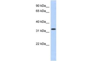 Western Blotting (WB) image for anti-metallophosphoesterase Domain Containing 2 (MPPED2) antibody (ABIN2463910) (MPPED2 Antikörper)