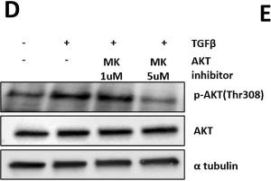 Western Blotting (WB) image for anti-alpha Tubulin (TUBA1) (C-Term) antibody (ABIN964563)