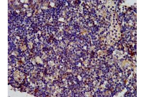 IHC image of ABIN7168933 diluted at 1:400 and staining in paraffin-embedded human tonsil tissue performed on a Leica BondTM system. (SPINK6 Antikörper  (AA 24-80))